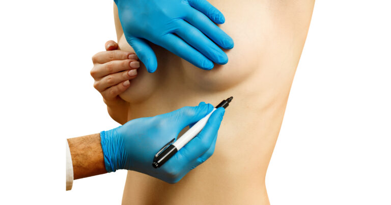 Breast Augmentation with Breast Implants in Islamabad